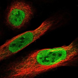 FAM9B Antibody, Novus Biologicals:Antibodies:Primary Antibodies